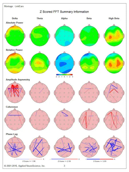 qEEG Based Personalization